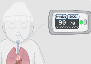 Exhalos-NEC Breath Sensor