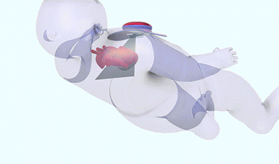 RAPIDscan